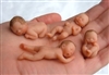 سقط های مکرر، باروری و آزمایش های ژنتیک